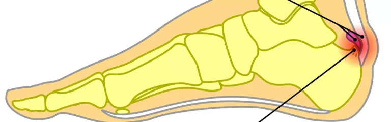 shutterstock_470719709-Converted-r1mw18m46fz7n4ozaq66q8thnfm8akiaxovxptci28